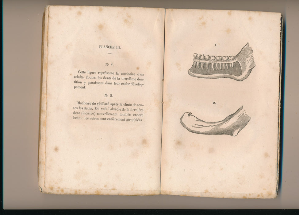 Paul Gresset Le dentiste des familles manuel d’hygiène de la bouche 1845 EO